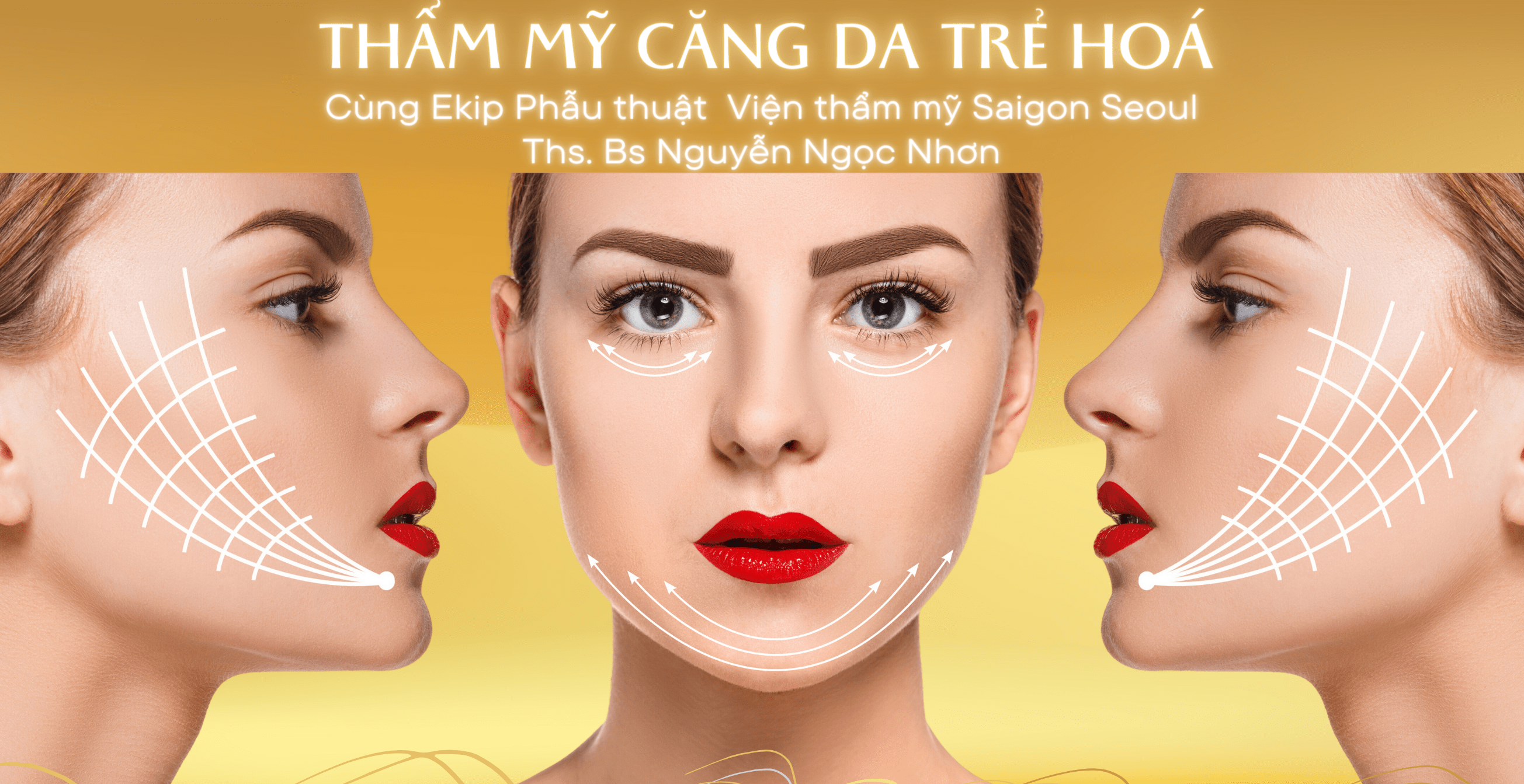 Read more about the article Phẫu thuật căng da mặt – Ths. bs Nguyễn Ngọc Nhơn