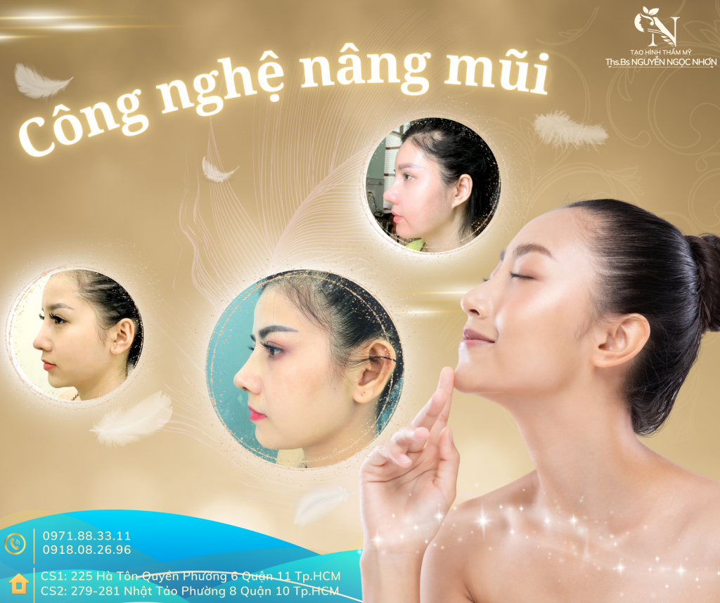 Công nghệ nâng mũi