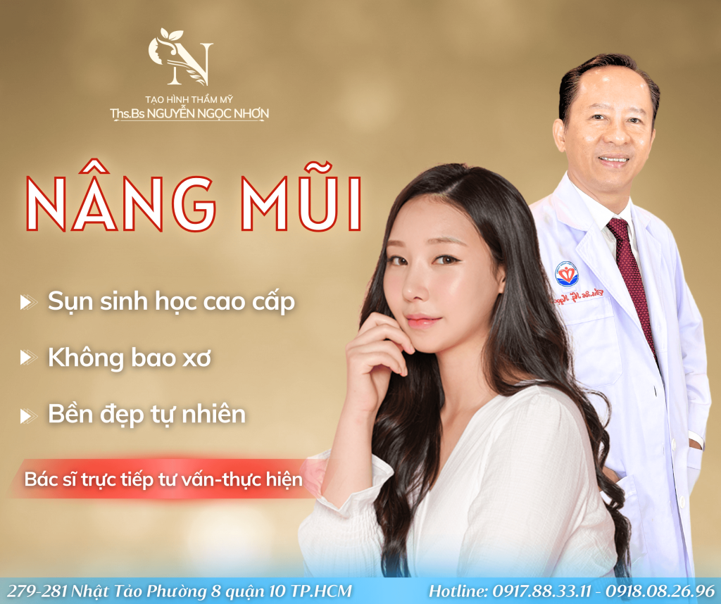 Nâng mũi cấu trúc