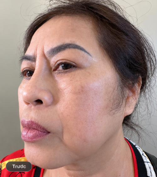 nang mui before
