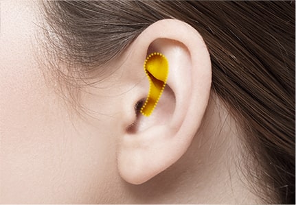 Hiểu hơn về nâng mũi sụn tự thân cùng Ths. Bs Nguyễn Ngọc Nhơn autologous cartilage rhinoplasty types 01