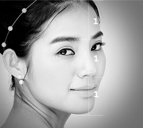 Phân tích 360 độ về dáng mũi thường gặp của người Châu Á | Ths. Bs Nguyễn Ngọc Nhơn nose surgery by type conditions 01