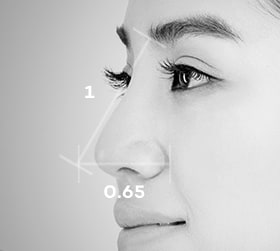 Phân tích 360 độ về dáng mũi thường gặp của người Châu Á | Ths. Bs Nguyễn Ngọc Nhơn nose surgery by type conditions 02