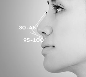 Phân tích 360 độ về dáng mũi thường gặp của người Châu Á | Ths. Bs Nguyễn Ngọc Nhơn nose surgery by type conditions 04