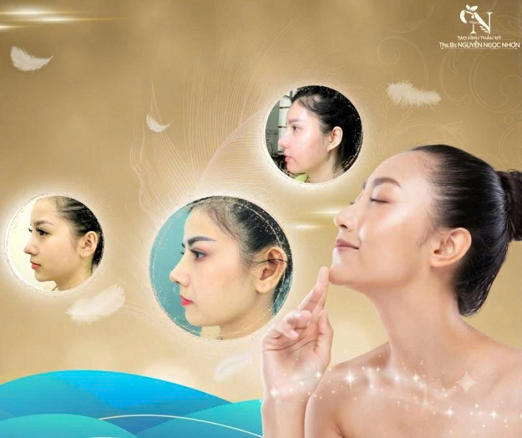 phau thuat tham my mui