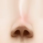 Sửa lại mũi đã phẫu thuật | Viện thẩm mỹ SaigonSeoul – Ths. Bs Nguyễn Ngọc Nhơn revision rhinoplasty doctors 01